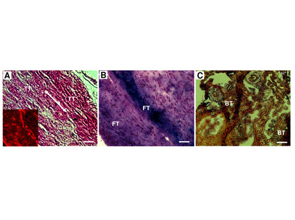 Immunohistochemistry using Collagen Type I